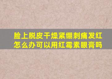 脸上脱皮干燥紧绷刺痛发红怎么办可以用红霉素眼膏吗